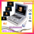Beliebte Ultraschall! MSLCU18i Neueste billige Laptop 4D Ultraschall Medizinische Geräte / 4d Ultraschall Maschine Preis